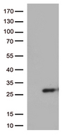 SSX4 Antibody - HEK293T cells were transfected with the pCMV6-ENTRY control. (Left lane) or pCMV6-ENTRY SSX4B. (Right lane) cDNA for 48 hrs and lysed. Equivalent amounts of cell lysates. (5 ug per lane) were separated by SDS-PAGE and immunoblotted with anti-SSX4B. (1:500)