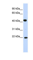 SSX4 Antibody - SSX4 antibody Western blot of Placenta lysate. This image was taken for the unconjugated form of this product. Other forms have not been tested.