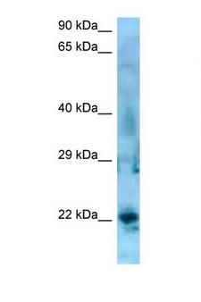 SSX5 Antibody - SSX5 antibody Western blot of Jurkat Cell lysate. Antibody concentration 1 ug/ml.  This image was taken for the unconjugated form of this product. Other forms have not been tested.