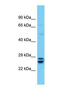 SSX5 Antibody - Western blot of Human Thymus Tumor. SSX5 antibody dilution 1.0 ug/ml.  This image was taken for the unconjugated form of this product. Other forms have not been tested.