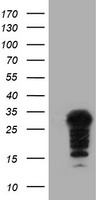 SSX5 Antibody - HEK293T cells were transfected with the pCMV6-ENTRY control (Left lane) or pCMV6-ENTRY SSX5 (Right lane) cDNA for 48 hrs and lysed. Equivalent amounts of cell lysates (5 ug per lane) were separated by SDS-PAGE and immunoblotted with anti-SSX5.