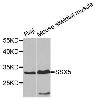SSX5 Antibody - Western blot analysis of extracts of various cells.