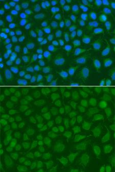 SSX5 Antibody - Immunofluorescence analysis of A549 cells.