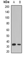 SSX5 Antibody - Western blot analysis of SSX5 expression in Raji (A); mouse skeletal muscle (B) whole cell lysates.
