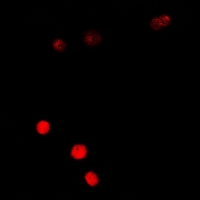 SSX5 Antibody - Immunofluorescent analysis of SSX5 staining in A549 cells. Formalin-fixed cells were permeabilized with 0.1% Triton X-100 in TBS for 5-10 minutes and blocked with 3% BSA-PBS for 30 minutes at room temperature. Cells were probed with the primary antibody in 3% BSA-PBS and incubated overnight at 4 deg C in a humidified chamber. Cells were washed with PBST and incubated with a DyLight 594-conjugated secondary antibody (red) in PBS at room temperature in the dark.