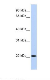 SSX5 Antibody - 721_B cell lysate. Antibody concentration: 1.0 ug/ml. Gel concentration: 12%.  This image was taken for the unconjugated form of this product. Other forms have not been tested.