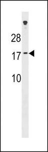 SSX7 Antibody - SSX7 Antibody western blot of A549 cell line lysates (35 ug/lane). The SSX7 antibody detected the SSX7 protein (arrow).