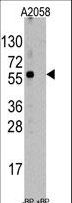 ST13 Antibody - Western blot of anti-ST13 Antibody pre-incubated with and without blocking peptide (BP6247a) in A2058 cell line lysate. ST13(arrow) was detected using the purified antibody.