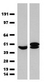 ST13 Antibody - HEK293T cells or pCMV6-ENTRY. (Right lane) cDNA for 48 hrs and lysed. Equivalent amounts of cell lysates. (5 ug per lane) were separated by SDS-PAGE and immunoblotted with anti-ST13  1:1000)
