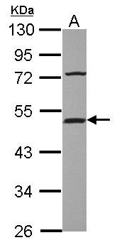 ST13 Antibody - Sample (30 ug of whole cell lysate) A: HepG2 10% SDS PAGE ST13 / HIP antibody diluted at 1:10000