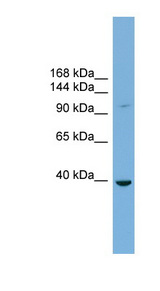 ST14 / Matriptase Antibody - ST14 / Matriptase antibody Western blot of THP-1 cell lysate. This image was taken for the unconjugated form of this product. Other forms have not been tested.