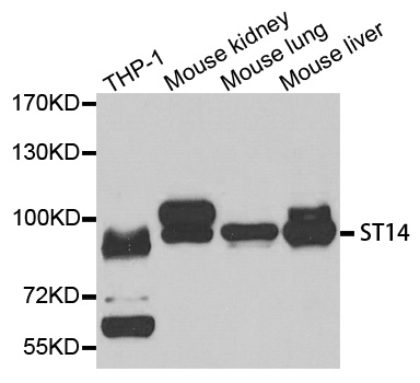 ST14 / Matriptase Antibody - Western blot analysis of extracts of various cell lines, using ST14 antibody.