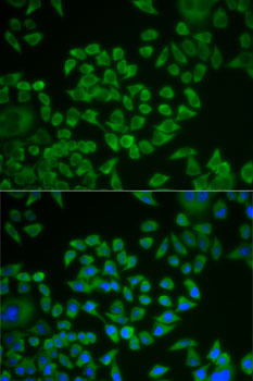 ST14 / Matriptase Antibody - Immunofluorescence analysis of U2OS cells using ST14 antibody. Blue: DAPI for nuclear staining.