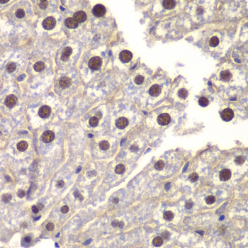 ST14 / Matriptase Antibody - Immunohistochemistry of paraffin-embedded mouse liver using ST14 antibody at dilution of 1:200 (40x lens).