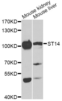 ST14 / Matriptase Antibody - Western blot analysis of extracts of various cell lines, using ST14 antibody at 1:1000 dilution. The secondary antibody used was an HRP Goat Anti-Rabbit IgG (H+L) at 1:10000 dilution. Lysates were loaded 25ug per lane and 3% nonfat dry milk in TBST was used for blocking. An ECL Kit was used for detection and the exposure time was 90s.
