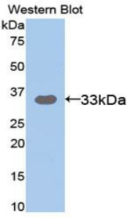 ST14 / Matriptase Antibody - Western blot of recombinant ST14 / Matriptase.  This image was taken for the unconjugated form of this product. Other forms have not been tested.