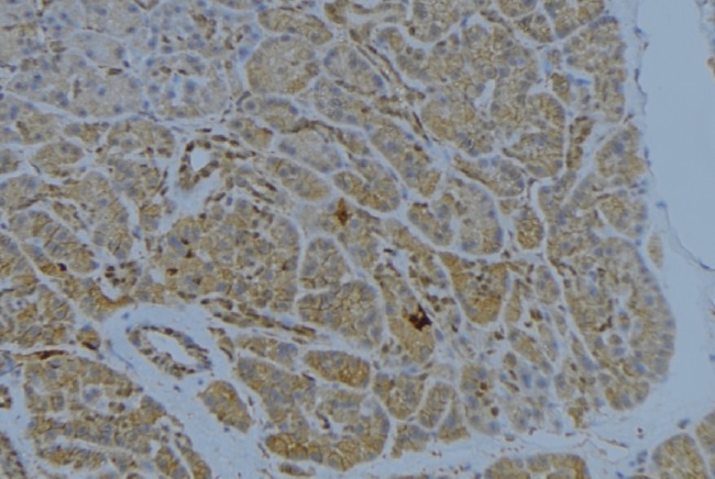 ST14 / Matriptase Antibody - 1:100 staining human pancreas tissue by IHC-P. The sample was formaldehyde fixed and a heat mediated antigen retrieval step in citrate buffer was performed. The sample was then blocked and incubated with the antibody for 1.5 hours at 22°C. An HRP conjugated goat anti-rabbit antibody was used as the secondary.