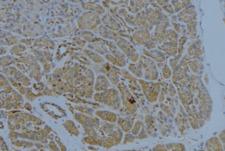 ST14 / Matriptase Antibody - 1:100 staining human pancreas tissue by IHC-P. The sample was formaldehyde fixed and a heat mediated antigen retrieval step in citrate buffer was performed. The sample was then blocked and incubated with the antibody for 1.5 hours at 22°C. An HRP conjugated goat anti-rabbit antibody was used as the secondary.