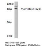 ST14 / Matriptase Antibody - Western blot of Matriptase (K21) pAb in extracts from HeLa cells.