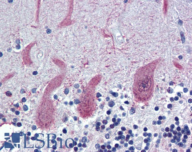 ST18 Antibody - Anti-ST18 antibody IHC of human brain, cerebellum. Immunohistochemistry of formalin-fixed, paraffin-embedded tissue after heat-induced antigen retrieval. Antibody concentration 5 ug/ml.  This image was taken for the unconjugated form of this product. Other forms have not been tested.