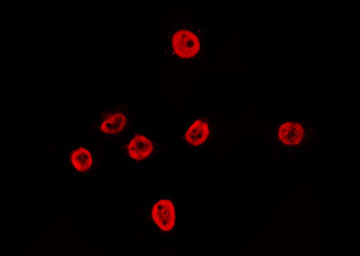 ST18 Antibody - Staining HuvEc cells by IF/ICC. The samples were fixed with PFA and permeabilized in 0.1% Triton X-100, then blocked in 10% serum for 45 min at 25°C. The primary antibody was diluted at 1:200 and incubated with the sample for 1 hour at 37°C. An Alexa Fluor 594 conjugated goat anti-rabbit IgG (H+L) Ab, diluted at 1/600, was used as the secondary antibody.