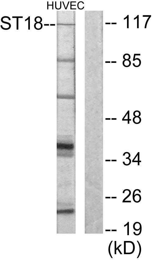 ST18 Antibody - Western blot analysis of extracts from HUVEC cells, using ZNF387 antibody.