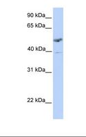 ST3GAL1 Antibody - Placenta lysate. Antibody concentration: 1.0 ug/ml. Gel concentration: 12%.  This image was taken for the unconjugated form of this product. Other forms have not been tested.