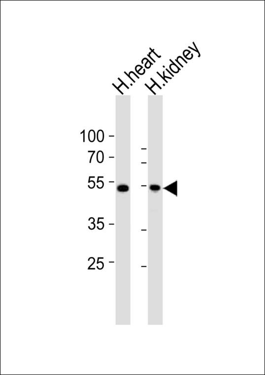 ST3GAL2 Antibody - Western blot of lysates from human heart and human kidney tissue (from left to right), using ST3GAL2 Antibody diluted at 1:1000 at each lane. A goat anti-rabbit IgG H&L (HRP) at 1:10000 dilution was used as the secondary antibody. Lysates at 20 ug per lane.