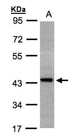 ST3GAL2 Antibody - Sample (30 ug whole cell lysate). A: H1299. 10% SDS PAGE. ST3GAL2 antibody diluted at 1:1000