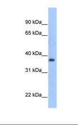 ST3GAL2 Antibody - Fetal heart cell lysate. Antibody concentration: 1.0 ug/ml. Gel concentration: 12%.  This image was taken for the unconjugated form of this product. Other forms have not been tested.