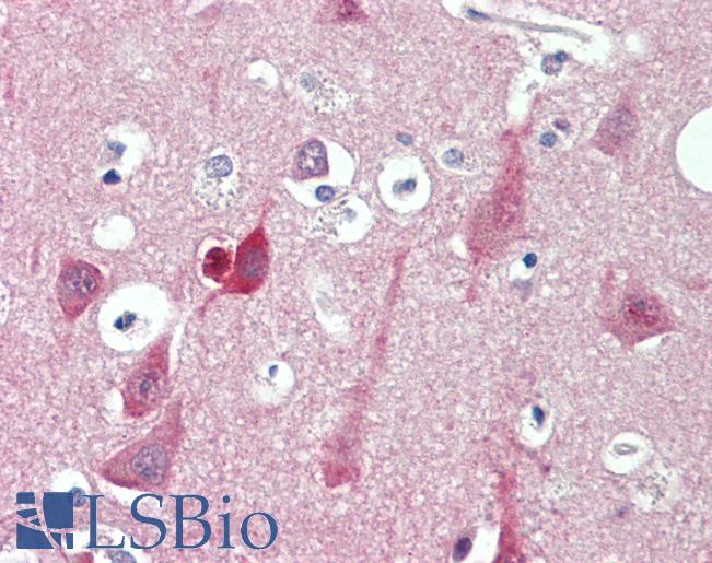 ST3GAL2 Antibody - Anti-ST3GAL2 antibody IHC staining of human brain, cortex. Immunohistochemistry of formalin-fixed, paraffin-embedded tissue after heat-induced antigen retrieval. Antibody concentration 10 ug/ml.  This image was taken for the unconjugated form of this product. Other forms have not been tested.