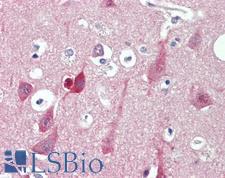 ST3GAL2 Antibody - Anti-ST3GAL2 antibody IHC staining of human brain, cortex. Immunohistochemistry of formalin-fixed, paraffin-embedded tissue after heat-induced antigen retrieval. Antibody concentration 10 ug/ml.  This image was taken for the unconjugated form of this product. Other forms have not been tested.