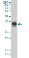 ST3GAL2 Antibody - ST3GAL2 monoclonal antibody (M01), clone 1E12 Western blot of ST3GAL2 expression in K-562.