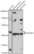 ST3GAL2 Antibody - Western blot analysis of extracts of various cell lines, using ST3GAL2 antibody at 1:3000 dilution. The secondary antibody used was an HRP Goat Anti-Rabbit IgG (H+L) at 1:10000 dilution. Lysates were loaded 25ug per lane and 3% nonfat dry milk in TBST was used for blocking. An ECL Kit was used for detection and the exposure time was 90s.