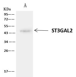ST3GAL2 Antibody - ST3GAL2 was immunoprecipitated using: Lane A: 0.5 mg U251MG Whole Cell Lysate. 1 uL anti-ST3GAL2 rabbit polyclonal antibody and 60 ug of Immunomagnetic beads Protein A/G. Primary antibody: Anti-ST3GAL2 rabbit polyclonal antibody, at 1:500 dilution. Secondary antibody: Clean-Blot IP Detection Reagent (HRP) at 1:1000 dilution. Developed using the ECL technique. Performed under reducing conditions. Predicted band size: 43 kDa. Observed band size: 45 kDa.