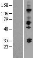 ST3GAL2 Protein - Western validation with an anti-DDK antibody * L: Control HEK293 lysate R: Over-expression lysate