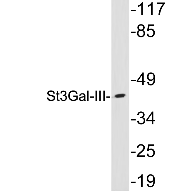 ST3GAL3 / ST3N Antibody - Western blot analysis of lysates from liver, using St3Gal-III antibody.
