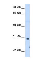 ST3GAL3 / ST3N Antibody - Fetal muscle cell lysate. Antibody concentration: 1.25 ug/ml. Gel concentration: 12%.  This image was taken for the unconjugated form of this product. Other forms have not been tested.