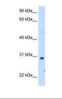 ST3GAL3 / ST3N Antibody - Fetal muscle cell lysate. Antibody concentration: 1.25 ug/ml. Gel concentration: 12%.  This image was taken for the unconjugated form of this product. Other forms have not been tested.
