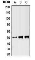 ST3GAL3 / ST3N Antibody - Western blot analysis of ST3N expression in HEK293T (A); NIH3T3 (B); PC12 (C) whole cell lysates.