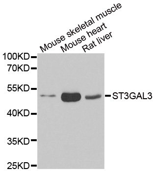 ST3GAL3 / ST3N Antibody - Western blot analysis of extracts of various cell lines.