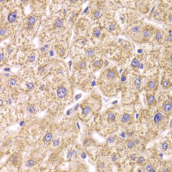 ST3GAL3 / ST3N Antibody - Immunohistochemistry of paraffin-embedded human liver injury tissue.