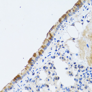 ST3GAL3 / ST3N Antibody - Immunohistochemistry of paraffin-embedded rat lung tissue.