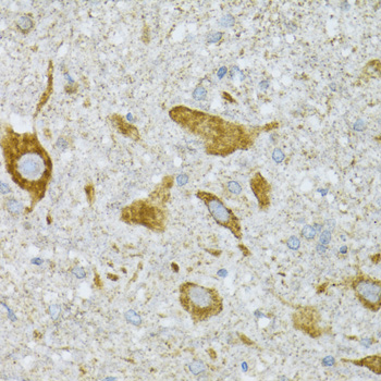 ST3GAL3 / ST3N Antibody - Immunohistochemistry of paraffin-embedded mouse spinal cord tissue.