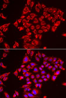 ST3GAL3 / ST3N Antibody - Immunofluorescence analysis of HeLa cells.
