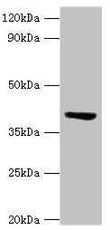 ST3GAL3 / ST3N Antibody - Western blot All Lanes: CMP-N-acetylneuraminate-beta-1,4-galactoside alpha-2,3-sialyltransferase antibody at 2ug/ml+mouse skeletal muscle tissue Secondary Goat polyclonal to Rabbit lgG at 1/15000 dilution Predicted band size: 43,44,20,50,39,22,12,32,13,21,23,18,49,17,41,31,16,47,26,27 kDa Observed band size: 42 kDa