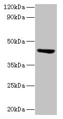ST3GAL3 / ST3N Antibody - Western blot All lanes: CMP-N-acetylneuraminate-beta-1, 4-galactoside alpha-2, 3-sialyltransferase antibody at 2µg/ml + Mouse skeletal muscle tissue Secondary Goat polyclonal to rabbit lgG at 1/15000 dilution Predicted band size: 43, 44, 20, 50, 39, 22, 12, 32, 13, 21, 23, 18, 49, 17, 41, 31, 16, 47, 26, 27 kDa Observed band size: 43 kDa