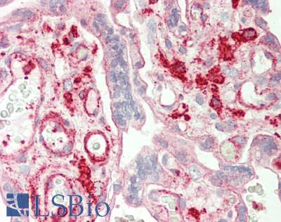 ST3GAL4 / ST3Gal IV Antibody - Human Placenta: Formalin-Fixed, Paraffin-Embedded (FFPE).  This image was taken for the unconjugated form of this product. Other forms have not been tested.