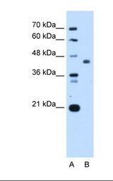 ST3GAL4 / ST3Gal IV Antibody - Lane A: Marker. Lane B: HepG2 cell lysate. Antibody concentration: 0.25 ug/ml. Gel concentration: 12%.  This image was taken for the unconjugated form of this product. Other forms have not been tested.
