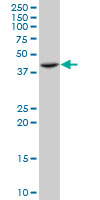 ST3GAL4 / ST3Gal IV Antibody - ST3GAL4 monoclonal antibody (M01), clone 1F4. Western Blot analysis of ST3GAL4 expression in MCF-7.